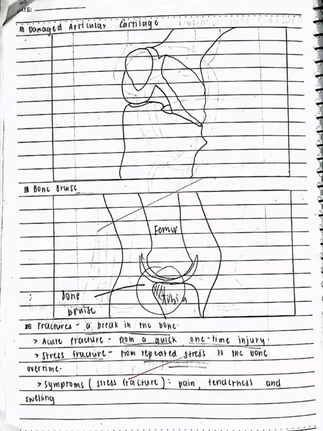 lecture notes in
ะะะ ะะ 9
03/02/24
Fitness
UNDERWEIGHT
EXCELLENT 5:
GOOD 3
FAIR 2
GOOD 1
MY GOOD SCORE: 8
SprengLeaf
DO NOT RE-UPLOAD | @jona